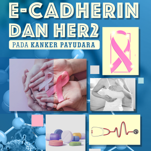 E-CADHERIN DAN HER2 PADA KANKER PAYUDARA