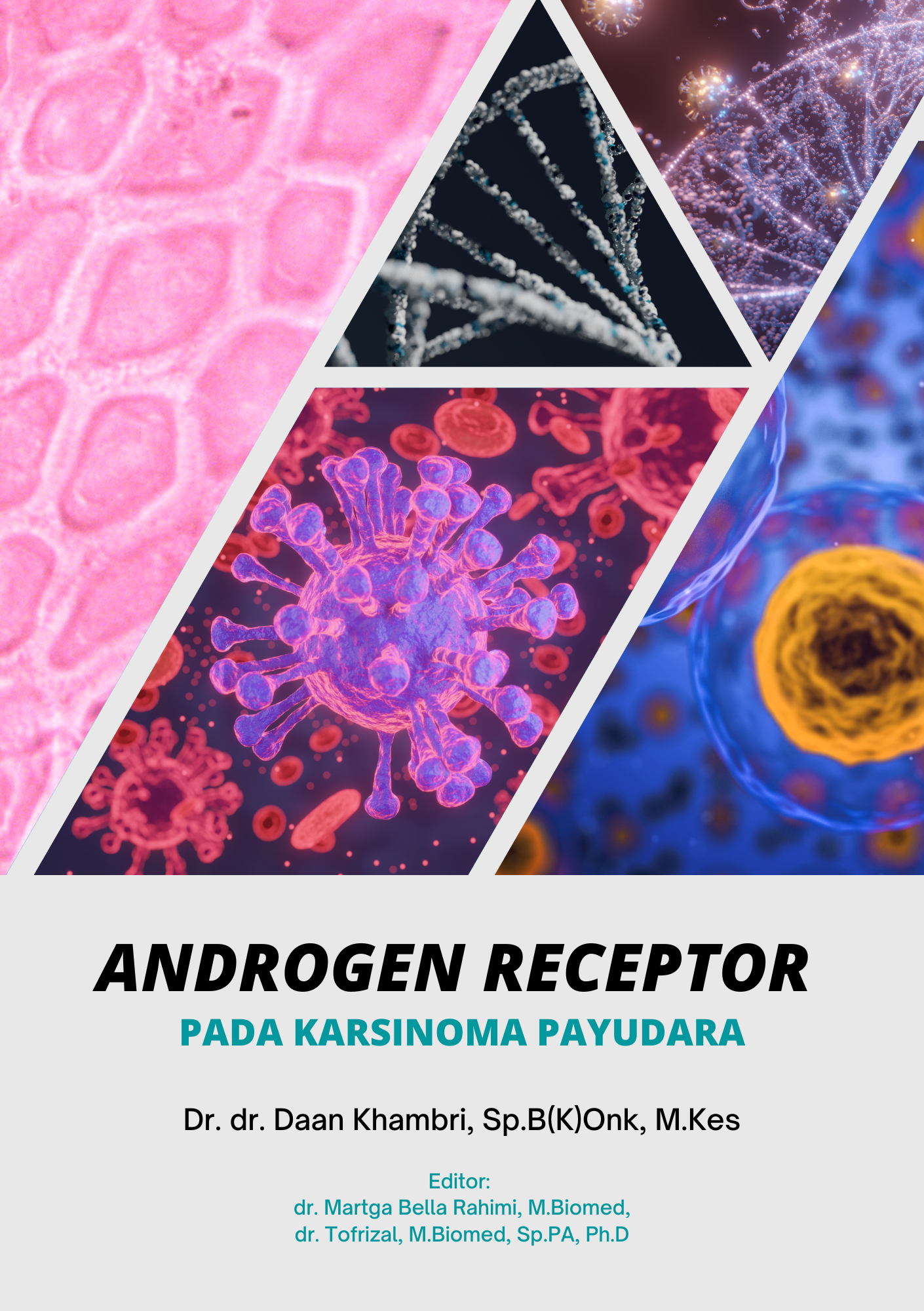 ANDROGEN RECEPTOR PADA KARSINOMA PAYUDARA - Dr. dr. Daan Khambri, Sp.B(K)Onk., M.Kes.